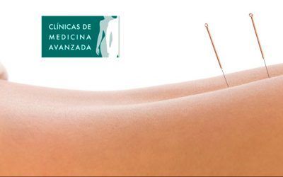 27 usos de la acupuntura