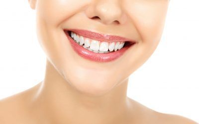 ¿Cómo conseguir unos dientes más blancos?